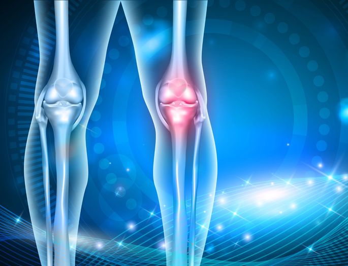 The illustration shows an X-ray view of the front sections of both knees. On the left side, a healthy knee is visible, with clearly defined bone and cartilage structures. On the right side, a red-marked area indicates pain and inflammation within the knee joint, suggesting the presence of osteoarthritis. The background of the illustration is blue with futuristic elements, emphasizing the medical and technological nature of the graphic.