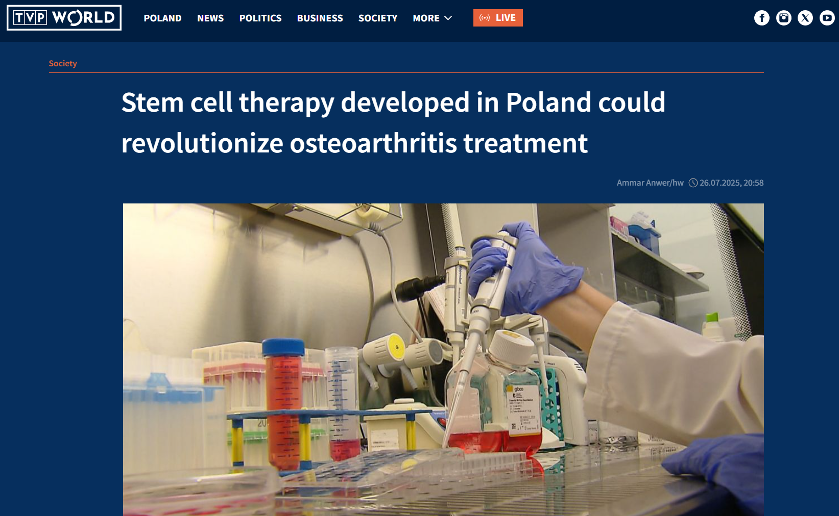 Zrzut ekranu artykułu TVP World zatytułowanego ‘Stem cell therapy developed in Poland could revolutionize osteoarthritis treatment’. Widoczna jest fotografia z laboratorium – osoba w rękawiczkach ochronnych pracuje przy stanowisku z pipetą, obok znajdują się naczynia z pożywkami i probówki.